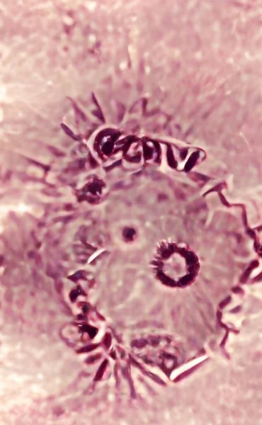 Επιδημία ιών, λοίμωξη από τον ιό Coronavirus covid 19, επικίνδυνη κενοντίτιδα — Φωτογραφία Αρχείου