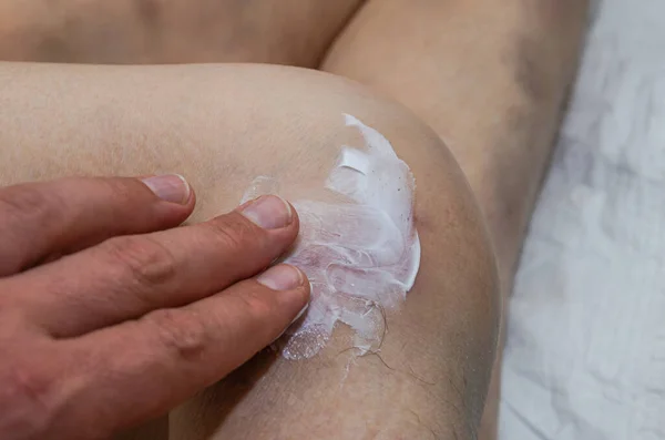Doctor Traumatologist Treats Bruise Injured Leg Knee Healing Ointment Elderly —  Fotos de Stock