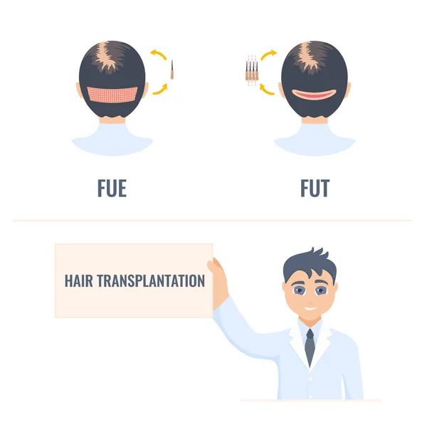 Transplante de cabelo infográficos do tratamento da alopecia feminina —  Vetores de Stock