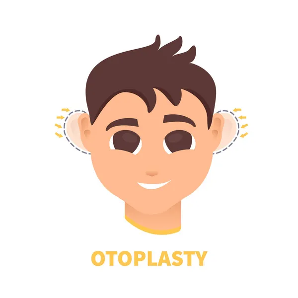 Man före och efter otoplasty öronkirurgi behandling — Stock vektor