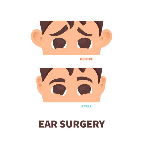 Homme avant et après otoplastie chirurgie de l'oreille traitement — Image vectorielle