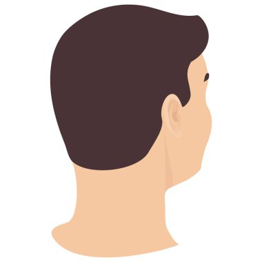 Saçları dökülmüş bir adamın kafası. Erkeklerde alopecinin farklı aşamaları. Sağlık ve güzellik konsepti. Vektör çizgi film illüstrasyonu