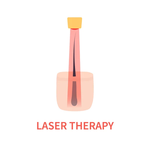 Laserbehandeling van alopecia met rode lichttherapie — Stockvector