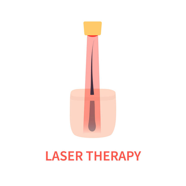 Laser red light therapy treatment of alopecia
