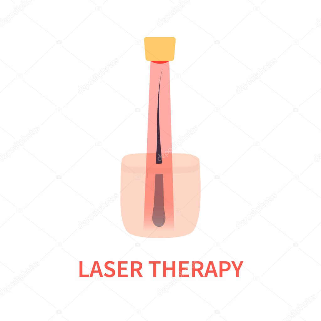Laser red light therapy treatment of alopecia