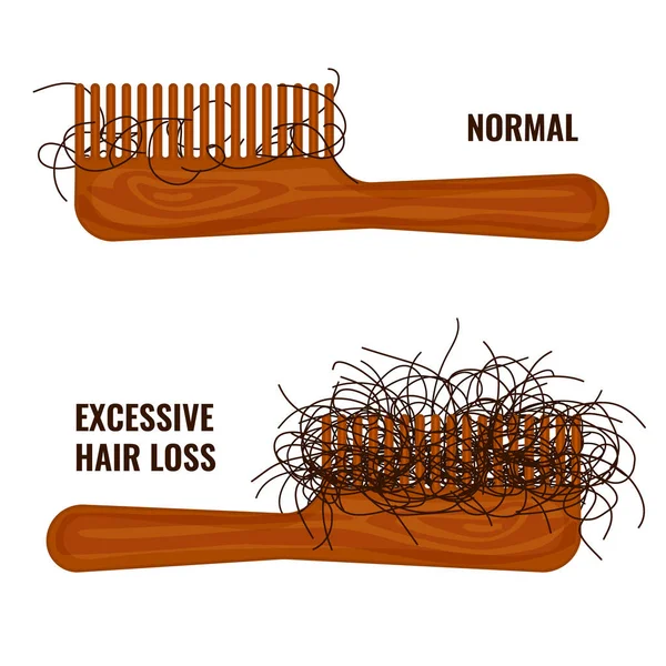 Combs showing different stages of hair loss — Image vectorielle