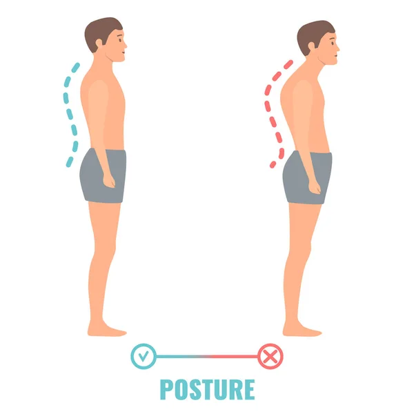 Good and bad posture comparison medical illustration — Vector de stock