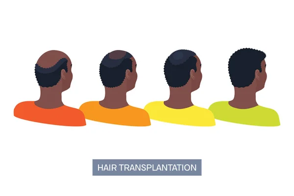 Afro Texturované Transplantace Vlasů Chirurgický Výsledek Infografiky Afričtí Mužští Pacienti — Stockový vektor