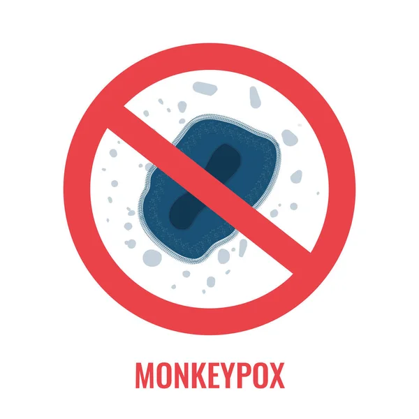 Monkeypox Vírus Infecção Estrutura Bactérias Poxvirus Doença Rara Cuidados Saúde — Vetor de Stock