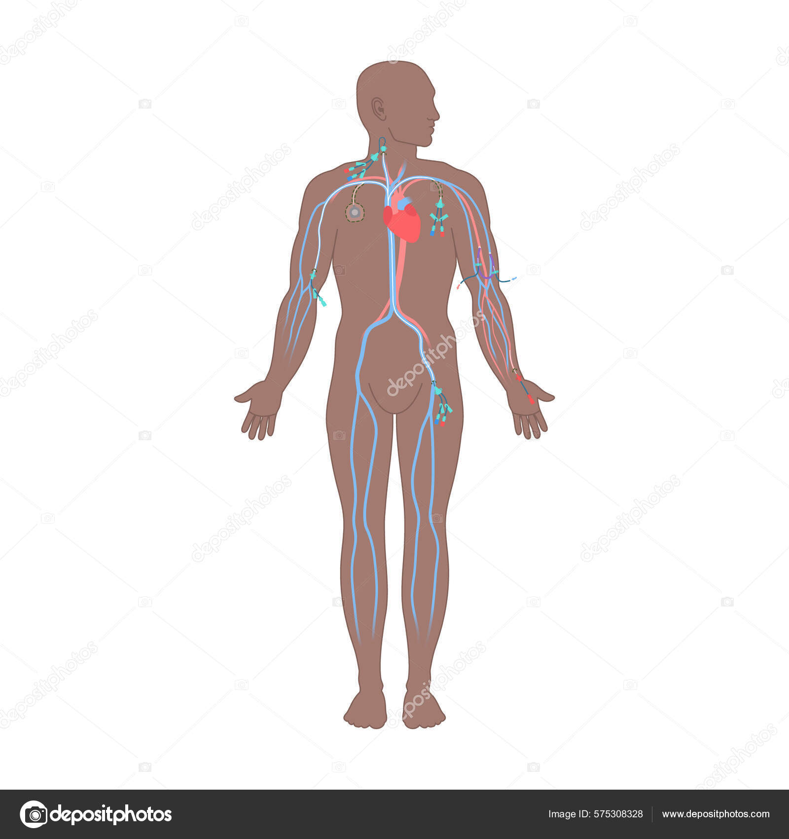 Central Venous Catheter Placement Sites Shown Male Body Types Central Stock Vector by ©Naumas