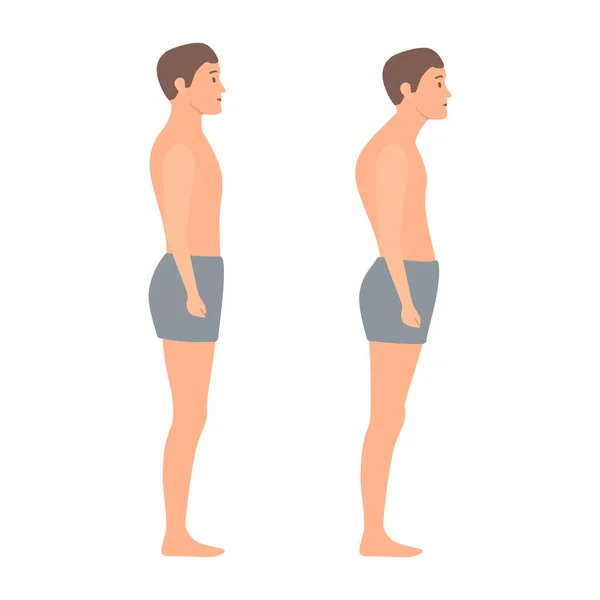 Boa Postura Corpo Masculino Vista Lateral Curvatura Coluna Vertebral Com —  Vetores de Stock
