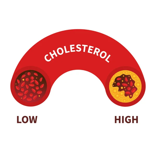 Cholesterol Level Blood Vessel Medical Diagram Meter Gauge Ldl Hdl — Stok Vektör
