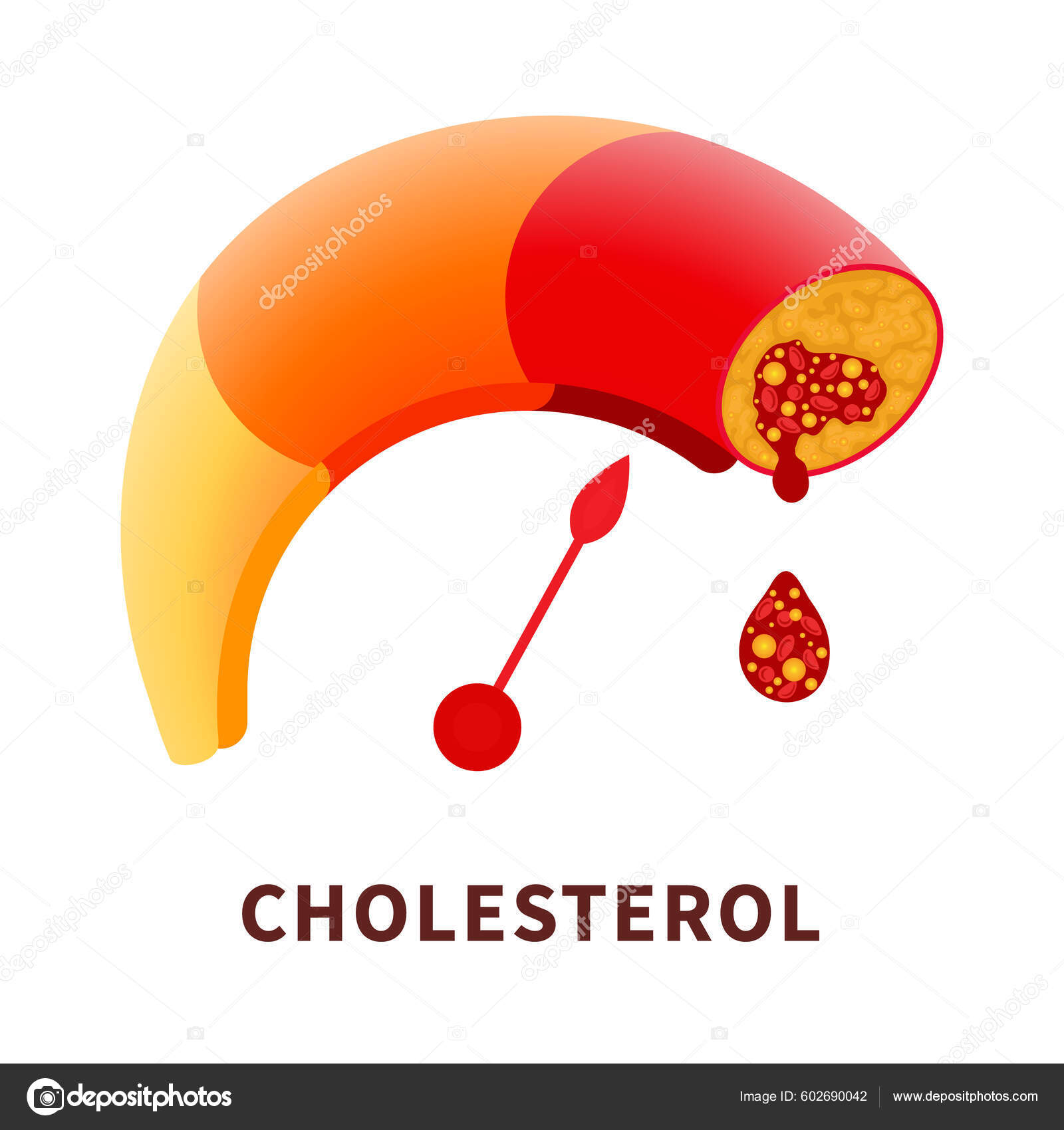 Cholesterol Level Blocked Blood Vessel Medical Diagram Meter Gauge Ldl