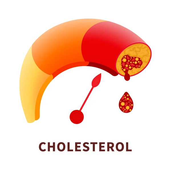 Cholesterol Level Blocked Blood Vessel Medical Diagram Meter Gauge Ldl — Stock vektor