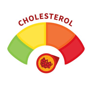 Cholesterol level on blocked blood vessel medical diagram. Meter gauge of ldl and hdl lipoprotein. High and low fat test indicator. Atherosclerosis risk. Healthcare concept. Vector illustration.