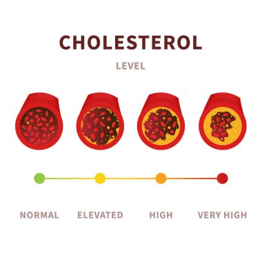 Cholesterol level in blood vessel medical diagram. Meter gauge of atherosclerosis in coronary artery. ldl and hdl lipoprotein. High and low fat test indicator. Healthcare concept. Vector illustration.