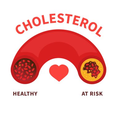 Cholesterol level on blood vessel medical diagram. Meter gauge of ldl and hdl lipoprotein. High and low fat test indicator. Coronary heart disease risk. Healthcare concept. Vector illustration.