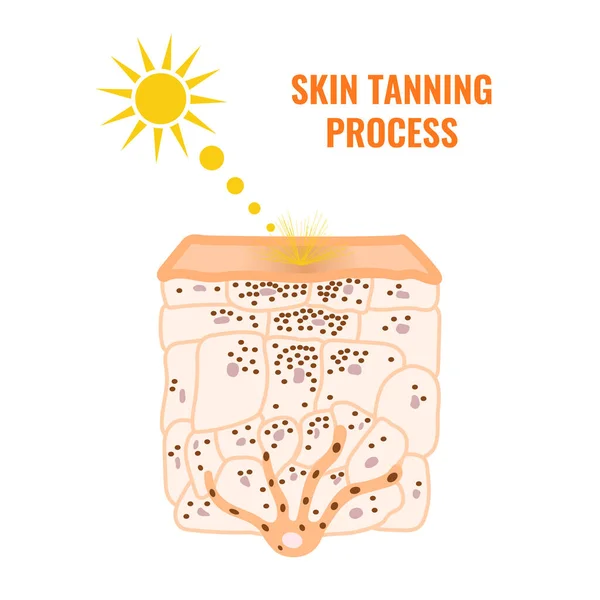 Skin Epidermis Cross Section Showing Change Melanin Distribution Tanned Skin — Stockvector
