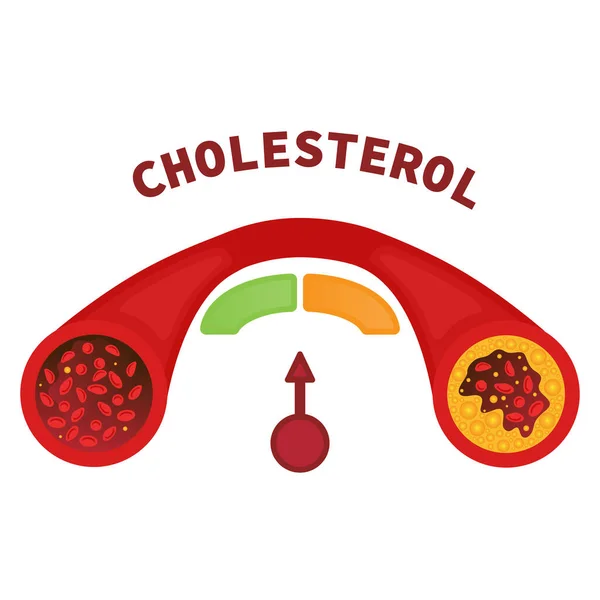Cholesterol Level Healthy Blocked Blood Vessel Medical Diagram Meter Gauge — Stock Vector
