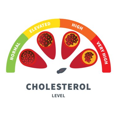 Arterde kolesterol plağının farklı aşamaları var. Kan damarı tıbbi diyagramında yağ oranı düşük. LDL ve HDL lipoprotein ölçer. Atheroskleroz risk göstergesi. Vektör illüstrasyonu.