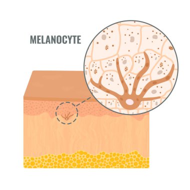 Melanocyte cell biology and skin tone pigmentation diagram. Melanin pigment production and distribution process. Melanosome transfer to keratinocytes in epidermis cross-section. Vector illustration.  clipart