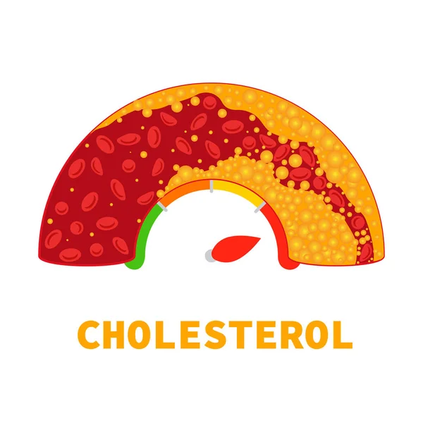 Cholesterol Level Blocked Blood Vessel Medical Diagram Meter Gauge Bad — Archivo Imágenes Vectoriales