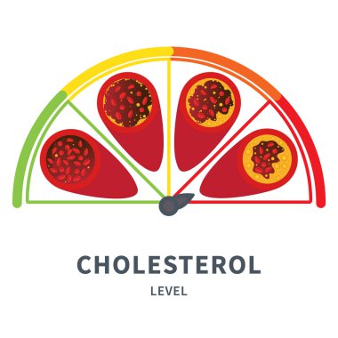 Cholesterol level on blocked blood vessel medical diagram. Atherosclerosis risk scale. Meter gauge of ldl and hdl lipoprotein. High and low fat test indicator. Healthcare concept. Vector illustration.