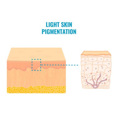 Melanin içeriği ve açık tenli dağıtım. Açık tenli pigmentasyon mekanizması bilgi grafiği. Epidermis enine kesiti yakın planda. Vektör illüstrasyonu.