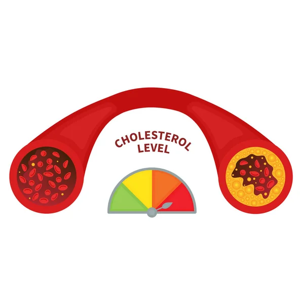 Hladina Cholesterolu Zdravém Zablokovaném Lékařském Diagramu Cév Měřič Ltl Ltl — Stockový vektor