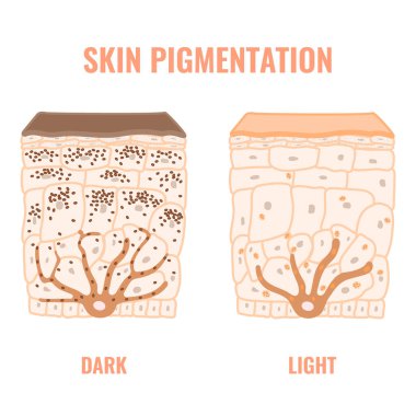 Melanin content and distribution in different skin phototypes. Pigmentation mechanism in dark and light skin. Epidermis cross-section infographic medical diagram. Vector illustration.