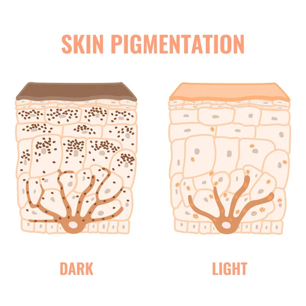 Melanin Content Distribution Different Skin Phototypes Pigmentation Mechanism Dark Light — Vettoriale Stock
