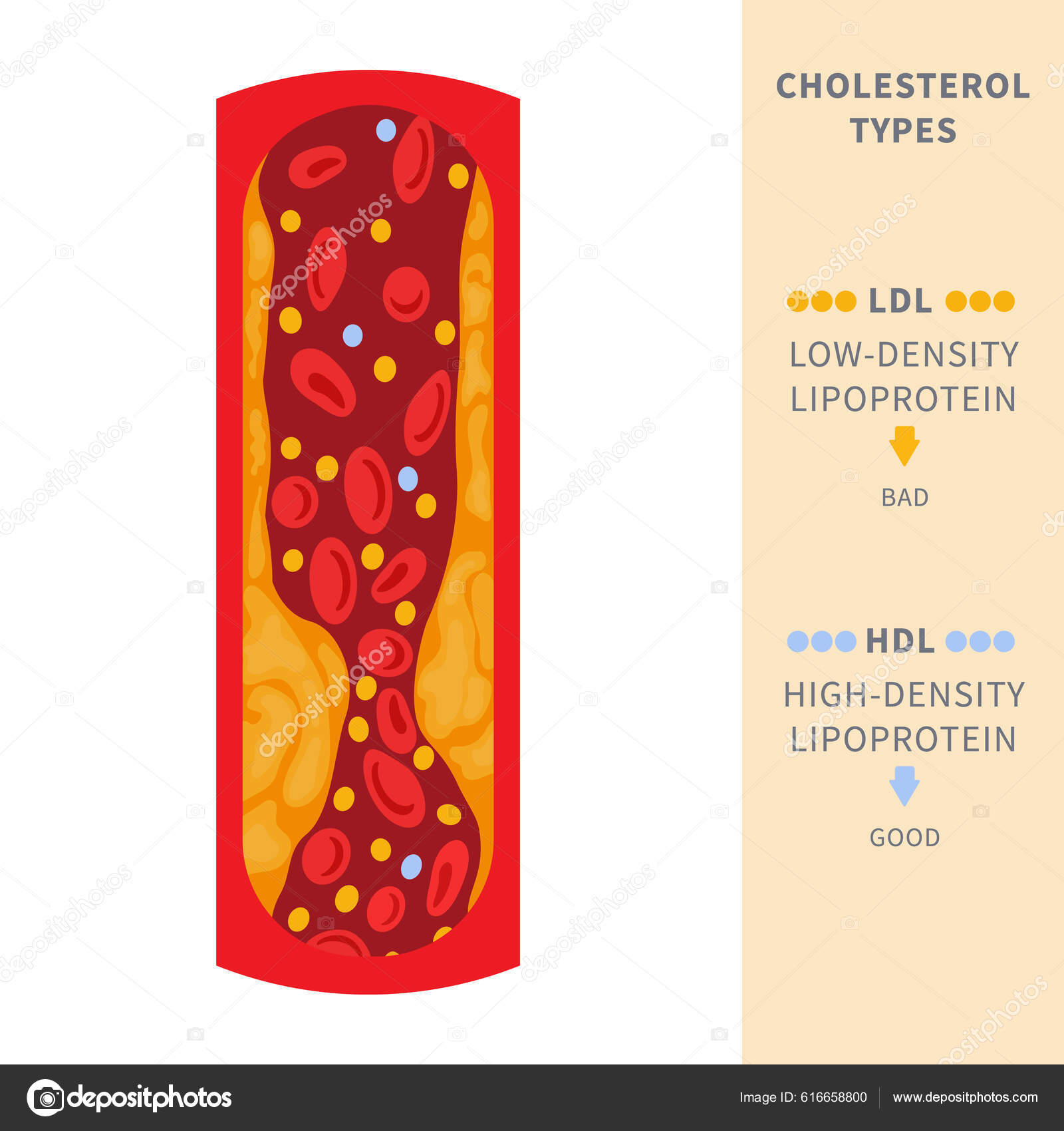31 Hyperlipidemia Stock Illustrations | DepositPhotos, image size:1600x1700