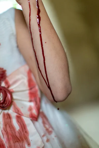 Blutspritzer Auf Weißem Kleid Hochwertiges Foto — Stockfoto