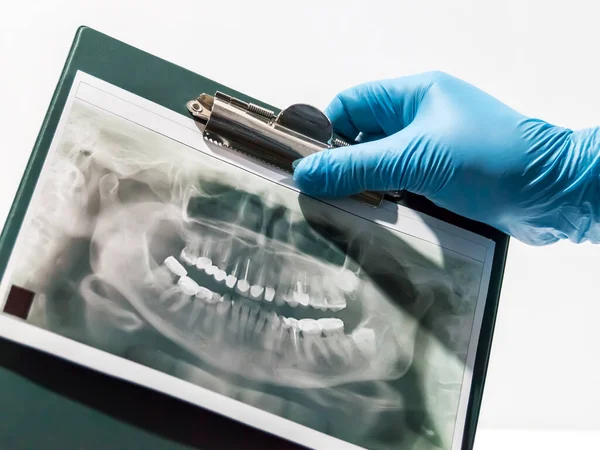 Uma Fotografia Paciente Está Mão Dentista Médico Examina Durante Recepção — Fotografia de Stock