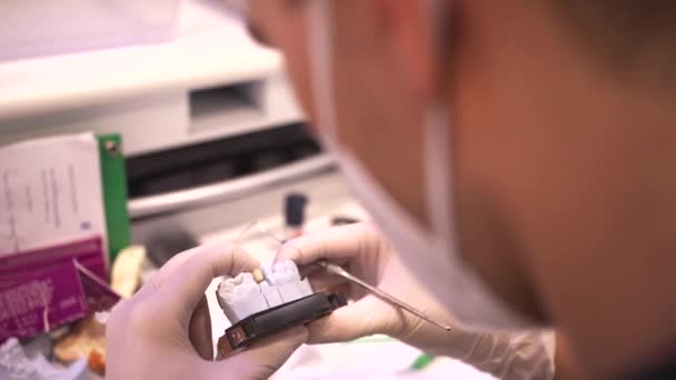 Creëren van een formulier voor tandheelkundige implantaten. — Stockvideo