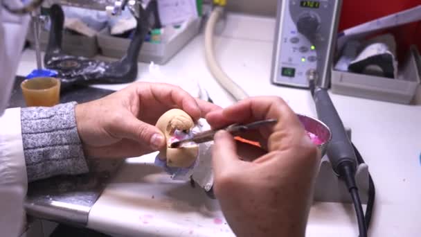 Creëren van een formulier voor tandheelkundige implantaten. — Stockvideo