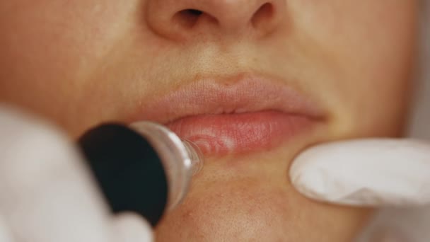 Pelar Los Labios Cuidado Piel Salón Belleza Imágenes Alta Calidad — Vídeos de Stock