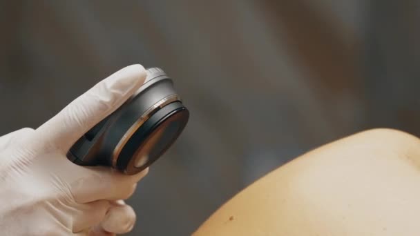Bir Dermatolog Bir Hastanın Cildine Bakar Yüksek Kalite Görüntü — Stok video