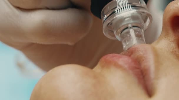 Professionele Face Peeling Met Een Gadget Dat Huid Wast Met — Stockvideo