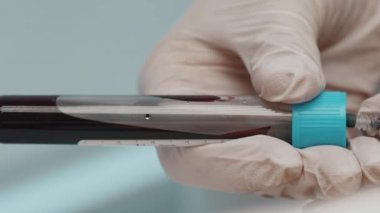 Kan testi yaptırıyorum. Yüksek kalite 4k görüntü