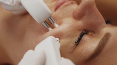 Kadın yüzünün profesyonel temizliği. Mikro akımlarla cilt tedavisi. Yüksek kalite 4k görüntü