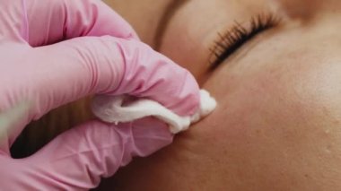 Göz bölgesinde kan plazması enjeksiyonu. Yüksek kalite 4k görüntü