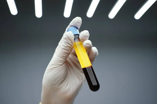 Injektioner Blodplasma Ansikte Och Huvud Högkvalitativ Film — Stockfoto
