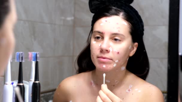 Woman face covered with red acne chickenpox disease — Stock Video