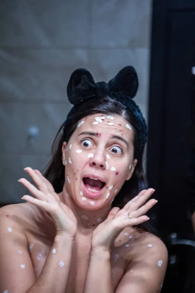 Mujer Adulta Retrato Varicela Enfermedad Reflejo Espejo Baño —  Fotos de Stock