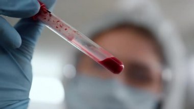 Teknisyen eli, test tüpünü kanla tutuyor. Doktor kan örneğini inceliyor. 