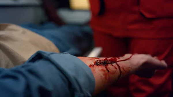 Μη αναγνωρίσιμος τραυματιοφορέας σε γάντια περιτύλιγμα ανδρικού χεριού με ελαστικό επίδεσμο — Φωτογραφία Αρχείου