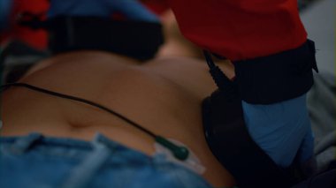 Tanımlanamayan EMS paramedik elleri hasta vücudunda defibrilatör ile kalp masajı yapıyor.