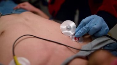 Acil servis doktorları EKG 'yi ölçmek için sensörler takıyor. 