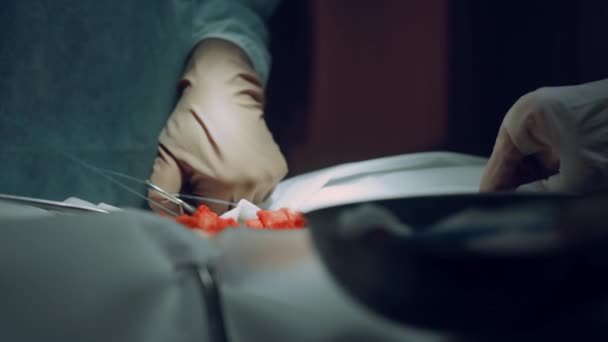Крупный план хирурга руки сшивания раны после успешной операции в клинике. — стоковое видео